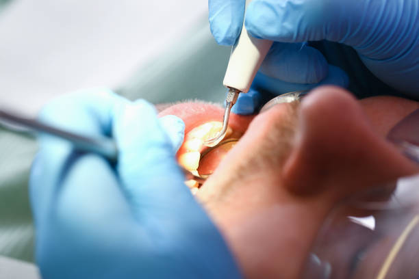 Best Same-Day Emergency Dentist in Kulpmont, PA